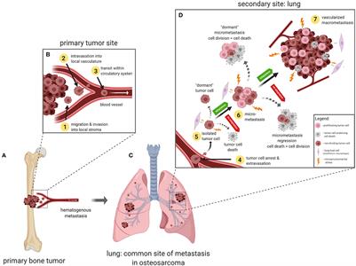 Understanding and Modeling Metastasis Biology to Improve Therapeutic Strategies for Combating Osteosarcoma Progression